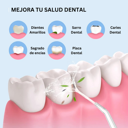 Irrigador Oral Anti-Sarro Recargable